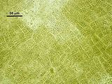 Dettaglio degli organi pluriloculari